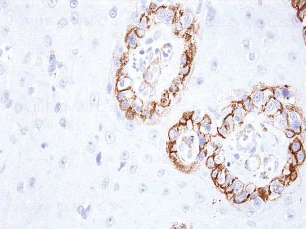 Anti-KBA.62 (Melanoma Associated Antigen) Monoclonal Antibody (Clone:IHC062)-Ready to Use
