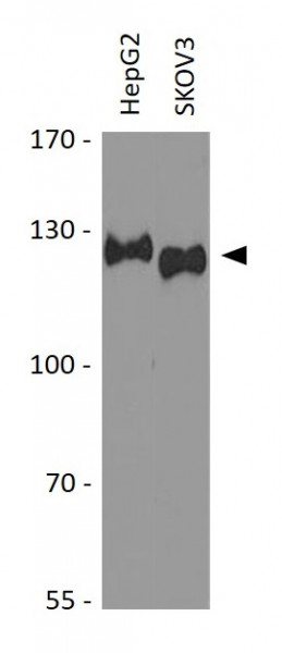 Anti-PARP (Full length)