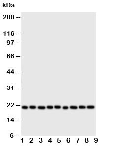 Anti-Cytoglobin
