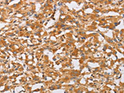 Anti-OLR1