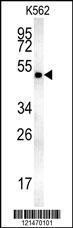 Anti-MINPP1, NT (MINPP1, MIPP, Multiple inositol polyphosphate phosphatase 1, 2,3-bisphosphoglycerat