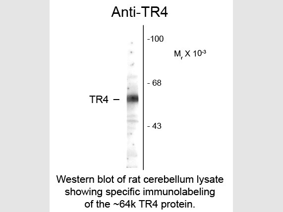 Anti-Testicular Receptor 4 (TR4)