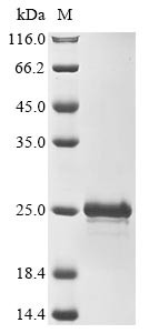 Thymosin beta-10 (Tmsb10), mouse, recombinant