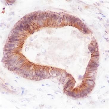 Anti-Recombinant FGFR2, clone A221