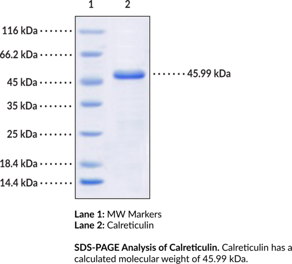 Calreticulin (human, recombinant)