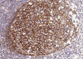 Anti-CD21 Monoclonal Antibody