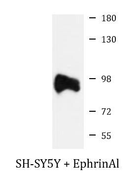 Anti-phospho-EphA2 (Tyr594)