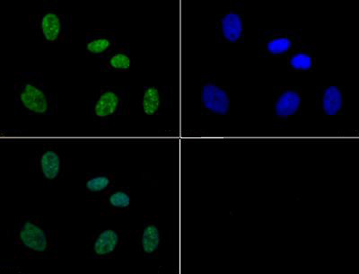 Anti-phospho-Histone H3 (p Thr11, p Ser10)