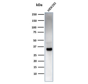 Anti-EBAG9 / Estrogen Receptor Binding Site Associated Antigen 9, clone CPTC-EBAG9-2