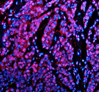 Anti-PABPN1 / Polyadenylate-binding protein 2