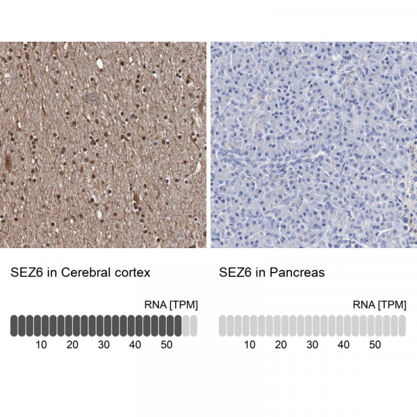Anti-SEZ6