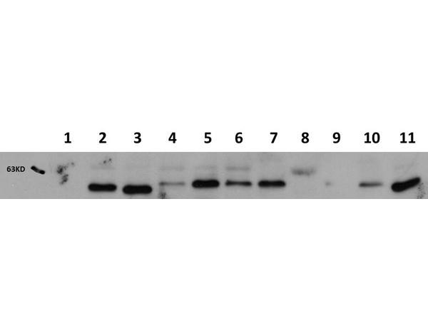 AKT1 Western Chemiluminescent Blotting Kit, clone 14E5.A2.B2.H9