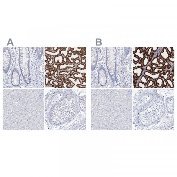 Anti-CSN3