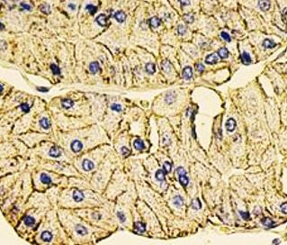 Anti-CA9 / Carbonic Anhydrase 9