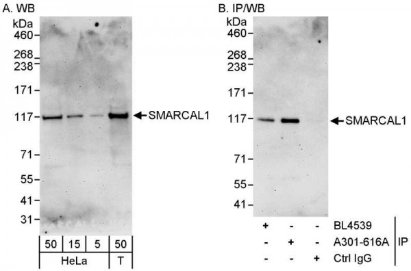 Anti-SMARCAL1