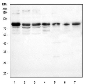 Anti-LMF2 / Lipase maturation factor 2
