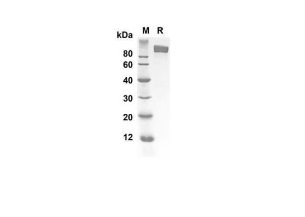 Recombinant Human IL6ST Protein(Fc Tag)
