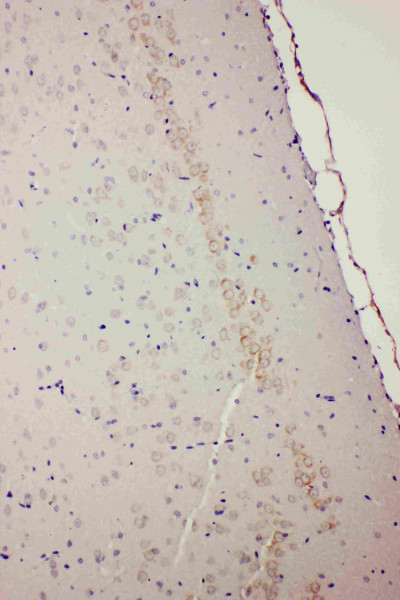 Anti-DRD1 / Dopamine Receptor D1