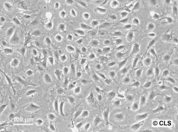 SVI Cells