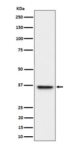 Anti-ULBP1 / UL16-binding protein 1, clone 30U90
