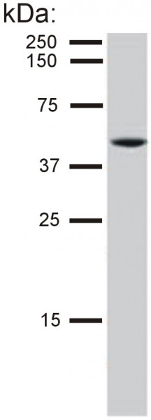 Anti-Cytokeratin 8, clone C-51