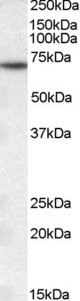 Anti-MTM1, C-terminal