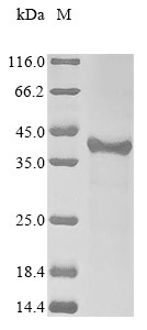 Izumo sperm-egg fusion protein 1 (IZUMO1), partial, human, recombinant