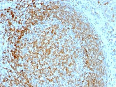Anti-CD74(LN-2), CF568 conjugate, 0.1mg/mL