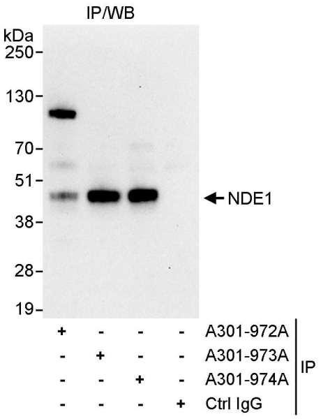 Anti-NDE1