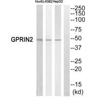 Anti-GPRIN2