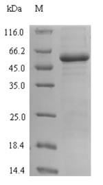 Lactose operon repressor (lacI), Escherichia coli, recombinant