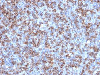 Anti-CD8A (Cytotoxic- &amp; Suppressor T-Cell Marker) (clone: C8/1779R) (recombinant rabbit monoclonal)