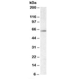 Anti-CCT3