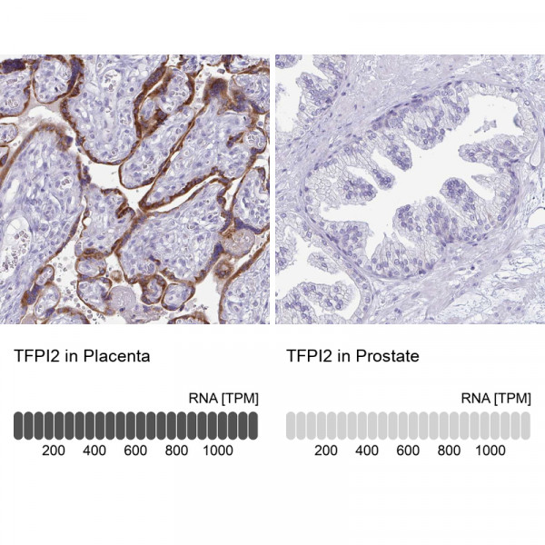 Anti-TFPI2