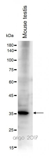 Anti-TATA-Binding Protein / TBP, clone 1TBP18