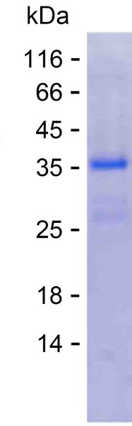 MUTYH (human), recombinant protein