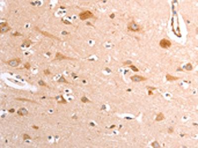 Anti-TRPV4