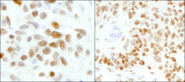 Anti-GTF2I/TFII-I