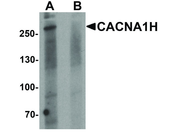 Anti-CACNA1H