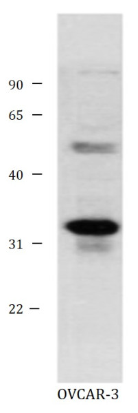 Anti-TMEM176B / LR8