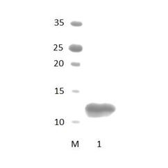 LDB3 PDZ Domain