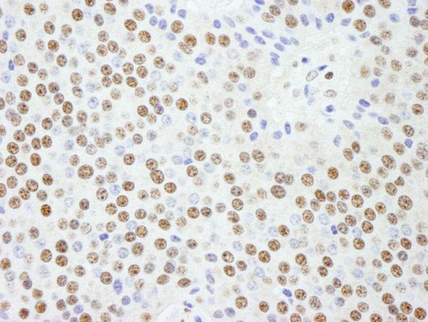 Anti-KPNA4 (IHC)