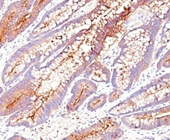 Anti-CEA / Carcinoembryonic Antigen, clone SPM584