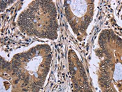 Anti-FGFRL1