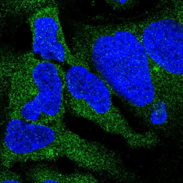 Anti-DYNC1I2