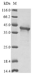 Interferon kappa (IFNK), human, recombinant
