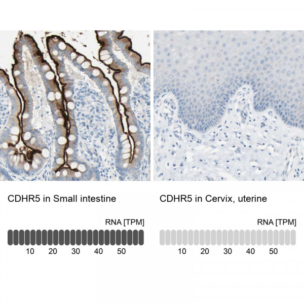 Anti-CDHR5