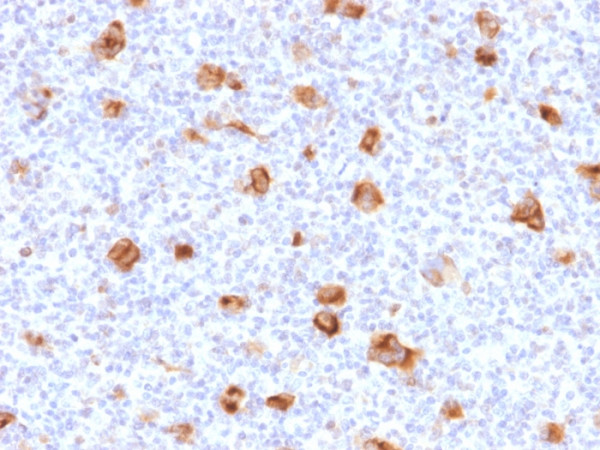Anti-Bcl-X (Apoptosis Marker), clone SPM519