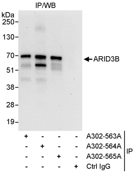 Anti-ARID3B