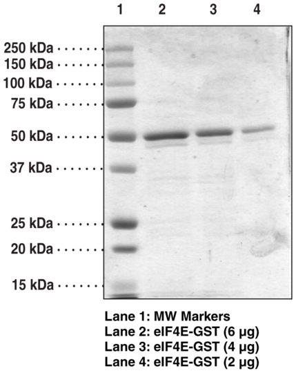 eIF4E (human recombinant, GST-tagged)